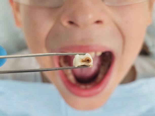 Best Same-Day Emergency Dental Services in Poth, TX