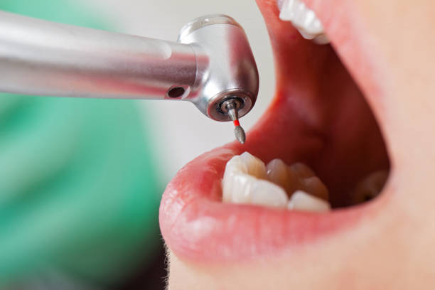 Best After-Hours Dental Trauma Care in Poth, TX